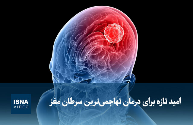 ویدیو/ امید تازه برای درمان تهاجمیترین سرطان مغز ویدیو/ امید تازه برای درمان تهاجمیترین سرطان مغز