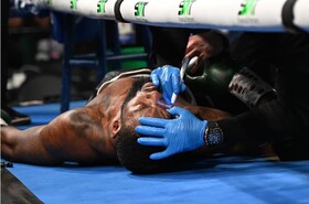 بیهوش شدن بوکسور آمریکایی روی رینگ + ویدیو