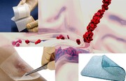 مسیر ۳۰ ساله یک پژوهش تا بازارهای جهانی/بیوپلیمرهای ایرانی در خدمت ترمیم زخم