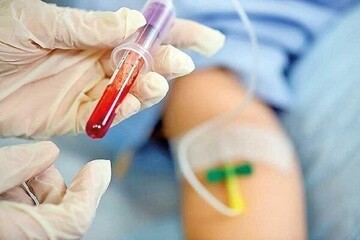 چرا باید به جای «حجامت» خون اهدا کنیم؟