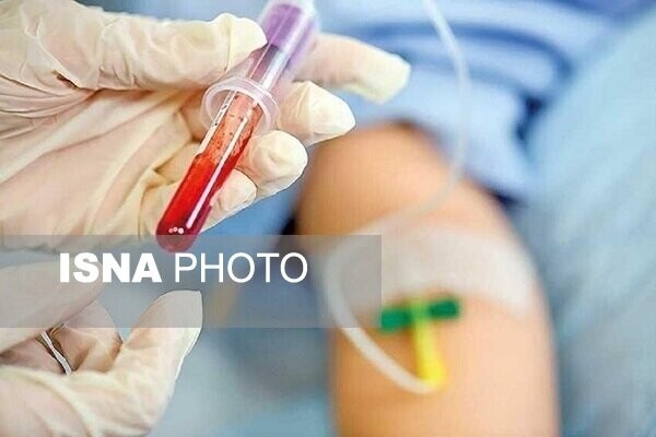 چرا باید به جای «حجامت» خون اهدا کنیم؟