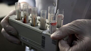 سازمان جهانی بهداشت: ابتلا به هپاتیت B در جهان کاهش یافته است