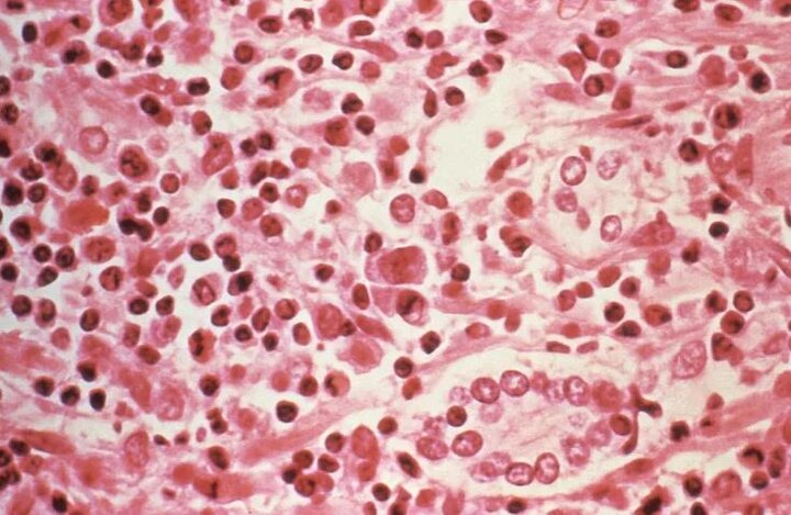 مرگ ۳ نفر در پی شیوع مشکوک ویروس «هانتا» در یک کشتی تفریحی در اقیانوس اطلس