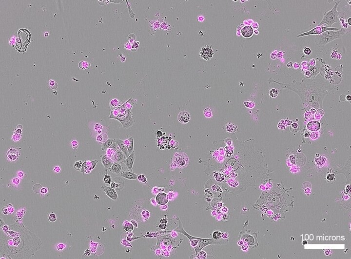 برش DNA سلول‌های بیمار با «قیچی ژنتیکی» جدید