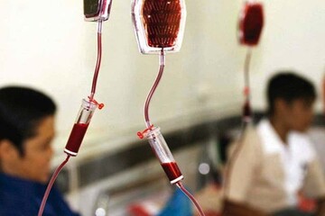 رئیس دانشگاه علوم پزشکی زاهدان: ۱۰ درصد مردم سیستان و بلوچستان ناقل ژن تالاسمی هستند