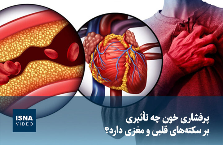 ویدیو/ پرفشاری خون چه تأثیری بر سکته‌های قلبی و مغزی دارد؟