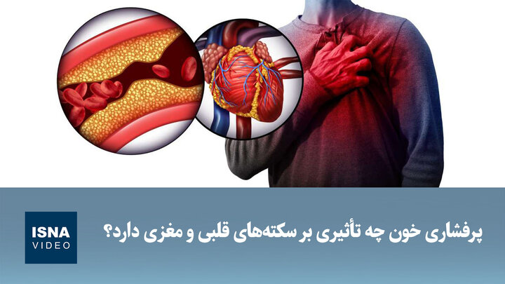 ویدیو/ پرفشاری خون چه تأثیری بر سکته‌های قلبی و مغزی دارد؟