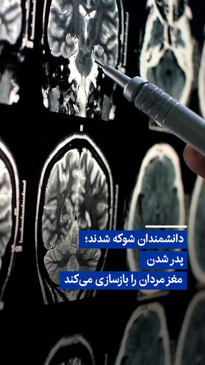 ویدیو/ دانشمندان شوکه شدند؛ پدر شدن مغز مردان را بازسازی می‌کند!