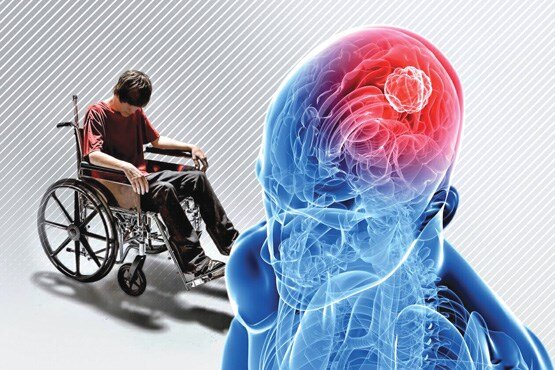پایان خانه به دوشی و راه اندازی کلینیک تخصصی بیماران «ام اس» آمل