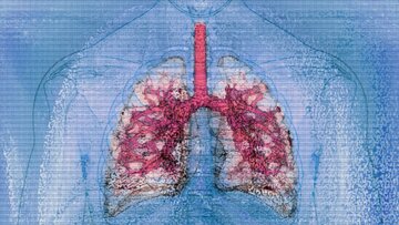 نخستین پیوند همزمان ریه و کبد میان دو فرد HIV مثبت