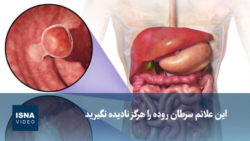 ویدیو/ این علائم سرطان روده را هرگز نادیده نگیرید