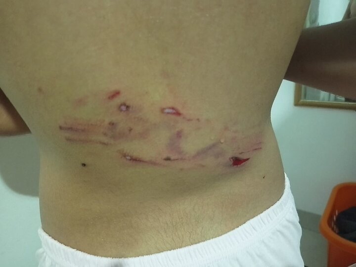 حمله سگهای بلاصاحب به دختر ۱۲ ساله در سنندج؛ زنگ خطر مدیریت شهری و مطالبه امنیت شهروندان