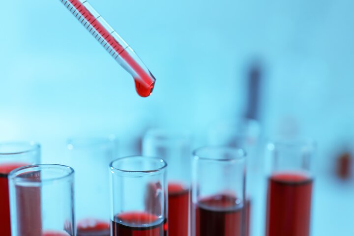 پیش‌بینی ۱۵ سال زودتر بیماری قلبی با یک آزمایش خون جدید