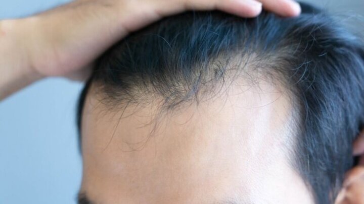 عارضه جانبی نگران‌کننده داروهای لاغری که هیچ‌کس در مورد آن صحبت نمی‌کند