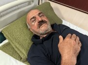 حمله قاچاقچی چوب به جنگلبان چالوسی در روز ملی جنگلبان