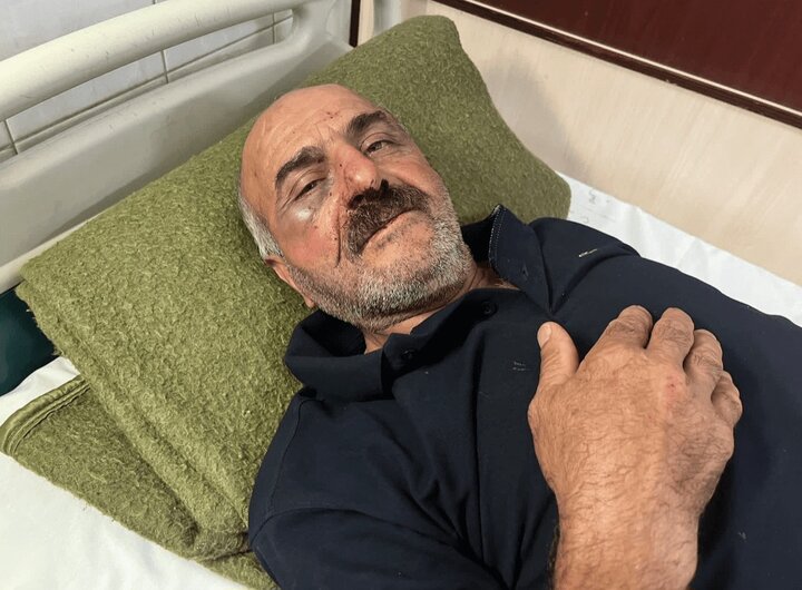 حمله قاچاقچی چوب به جنگلبان چالوسی در روز ملی جنگلبان