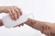 ثبت ۶۵۰ مورد گزش حیوانات در ملایر از ابتدای امسال