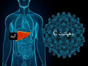 هشدار نسبت به ابعاد خاموش هپاتیت C؛ راه‌های انتقال و ضرورت تشخیص زودهنگام
