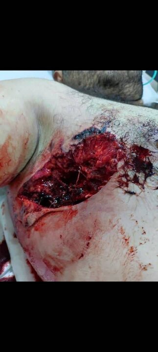 جعل مرگ بعد از شلیک به یک شهروند/ متهم فراری دستگیر شد