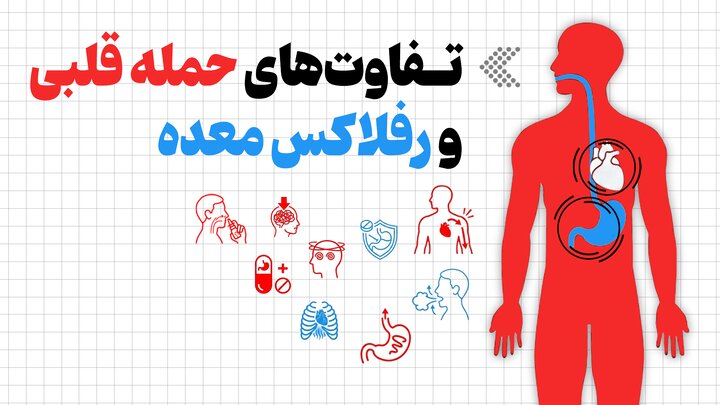 اینفوگرافیک/ تفاوت‌های حمله قلبی و رفلاکس معده