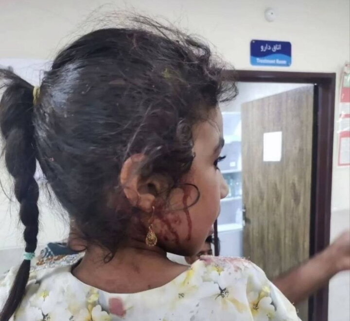 بقایی: حمله به مراسم عروسی در سیریک، نشانه دیگری از سقوط اخلاقی آمریکا است