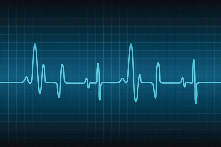 تپش قلب، همیشه یک هشدار «قلبی» نیست 