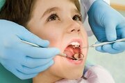 اجرای برنامه‌های آموزشی سلامت دهان و دندان در مدارس اسدآباد با تأکید بر پیشگیری از پوسیدگی