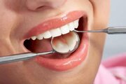 آغاز پویش ملی سلامت دهان و دندان در خراسان شمالی