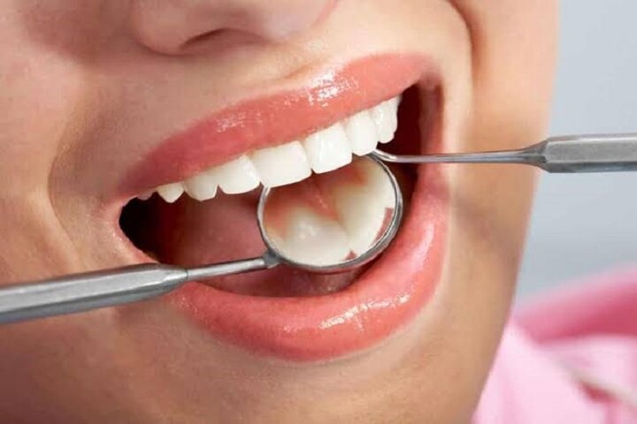 آغاز پویش ملی سلامت دهان و دندان در خراسان شمالی