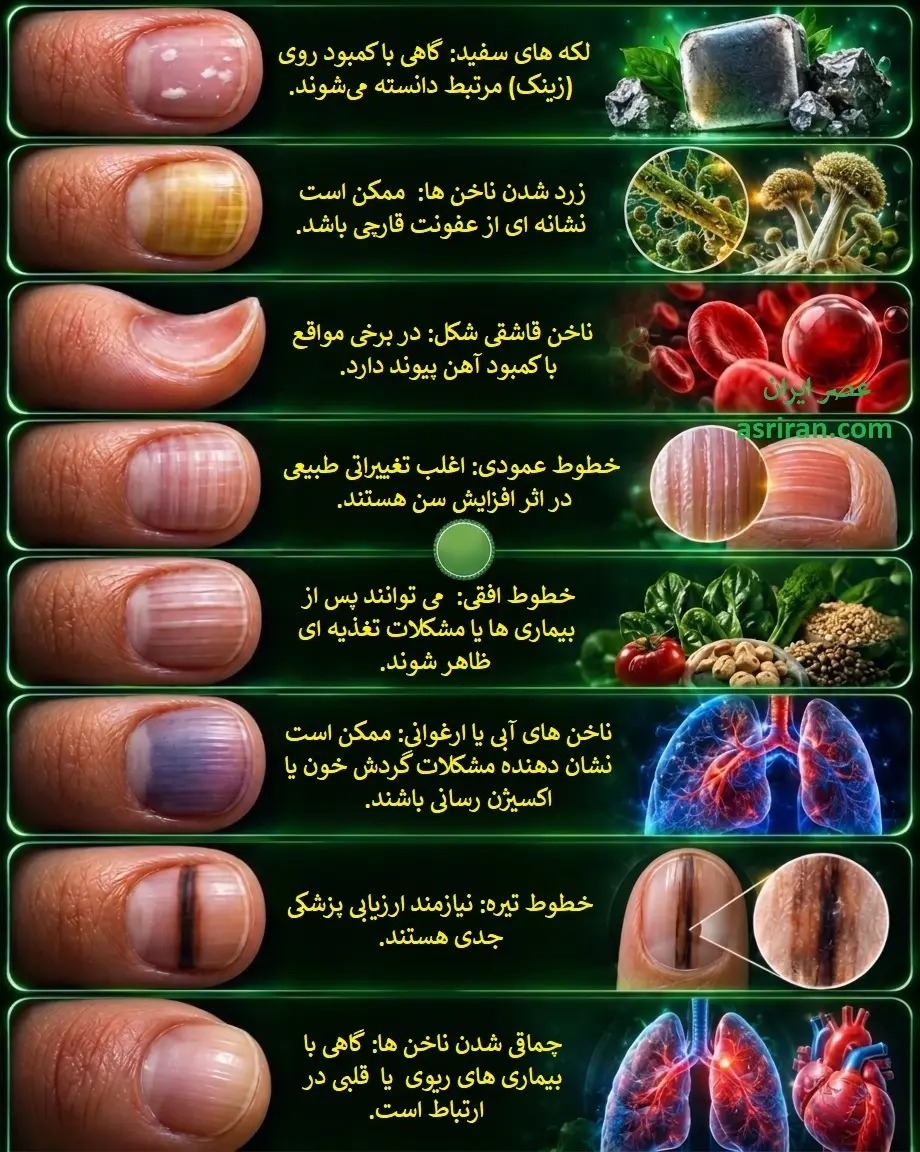 شکل و ظاهر ناخن شما درباره سلامتی چه می‌گوید؟