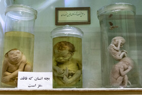 بخشی از موزه مربوط به انسان است، در این بخش جنین‌هایی از انسان در مراحل مختلف رشد وجود دارد که علاوه بر تحقیقات دانشگاهی در معرض دید عموم هم قرار گرفته است.