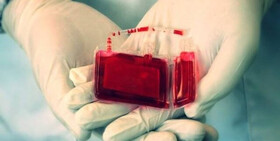 ذخیره‌سازی خون بند ناف سه‌قلوهای البرز