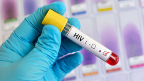 آگاهی و تبعیت درمان کلید طول عمر طبیعی مبتلایان HIV