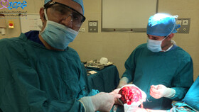 درمان توده کلیوی به روش رادیولوژی مداخله‌ای 