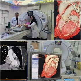 اولین سی‌تی‌اسکن آنژیوگرافی تاوی قلب در استان اردبیل انجام شد