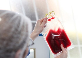 افزایش ۳۷ درصدی ذخیره خون بند ناف در خراسان جنوبی