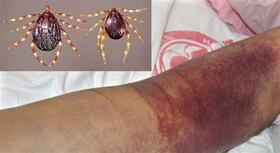 ریشه کنی ویروس تب کریمه کنگو امکان پذیر نیست