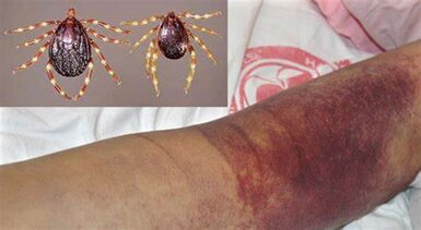 ریشه کنی ویروس تب کریمه کنگو امکان پذیر نیست