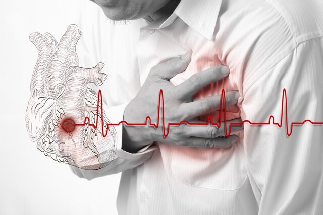دردی از قفسه سینه که می‌تواند به سکته قلبی منجر شود 
