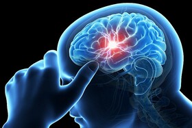 سردردهای بیماران مبتلا به بیماری کووید ۱۹سبب سکته مغزی نمی شود