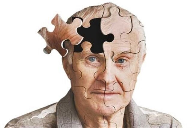 چگونه از ابتلا به آلزایمر پیشگیری کنیم؟