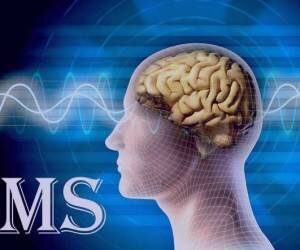 افزایش مبتلایان به ام اس در خراسان شمالی