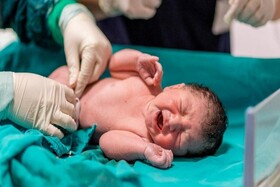 تولد نخستین نوزاد با روش زایمان بدون درد در سمنان