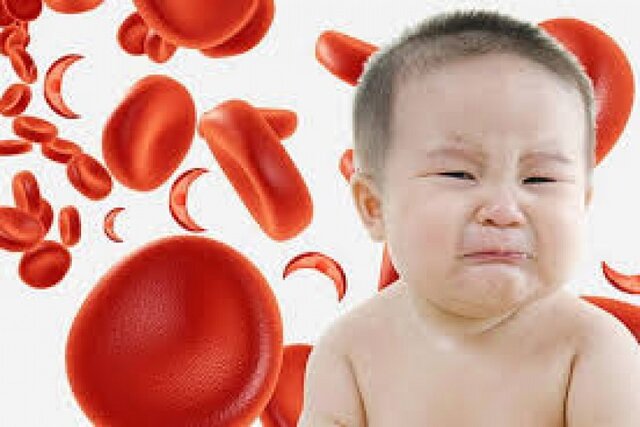 عوارض کم خونی‌های بی‌نشانه در کودکان چیست؟