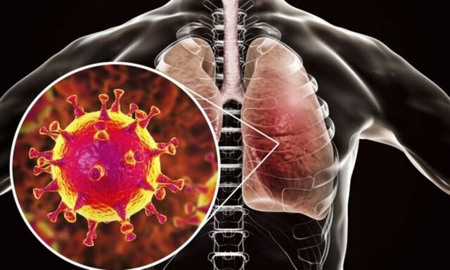 ویروس کرونا عامل ایجاد عفونت های حاد تنفسی است 

