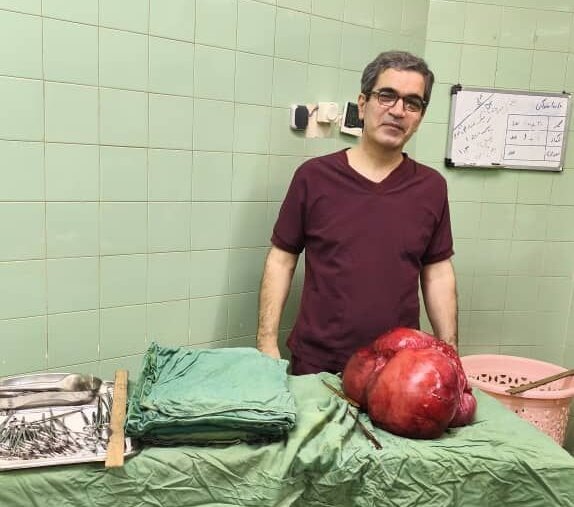 خارج کردن توده ۱۰ کیلویی از شکم بیمار پس از سال‌ها درد