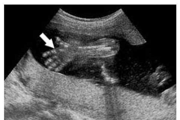 گلایههای یک متخصص زنان، زایمان و نازایی از طرح حذف غربالگری گلایههای یک متخصص زنان، زایمان و نازایی از طرح حذف غربالگری