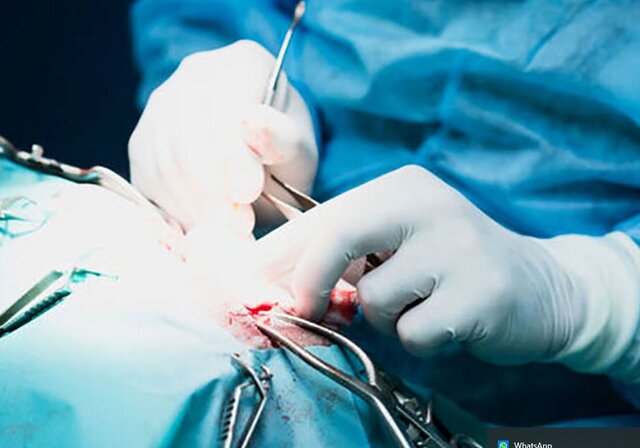 خروج توده ۲.۵ کیلویی از شکم زن کبودراهنگی خروج توده ۲.۵ کیلویی از شکم زن کبودراهنگی