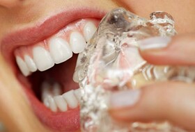 عادت‌هایی که به دندان‌های شما آسیب می‌زند