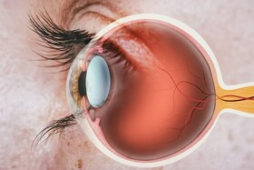 سلول‌های بنیادی و امید به بازیابی بینایی